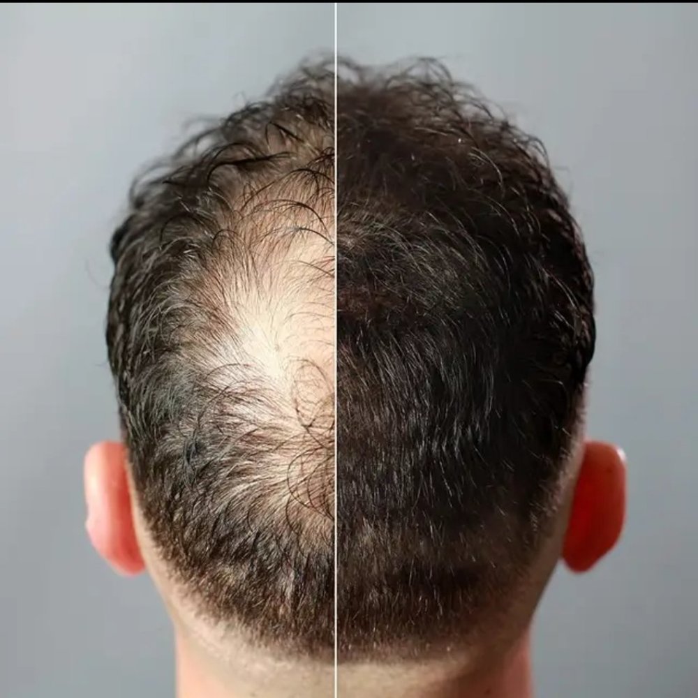 3 Toppik hair fiber (black) - Picture 3 of 3